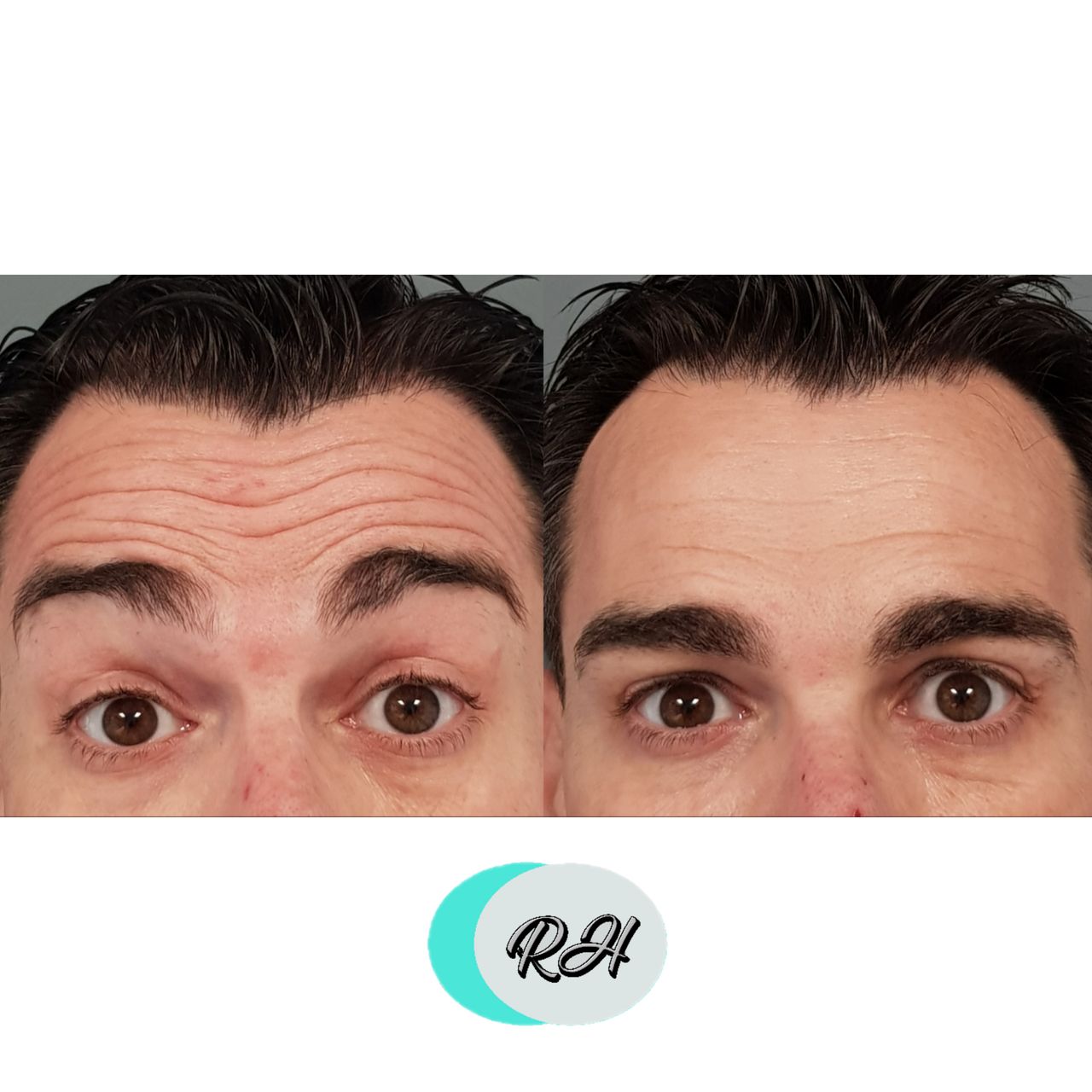 Rosalba Herrero Zerpa-176