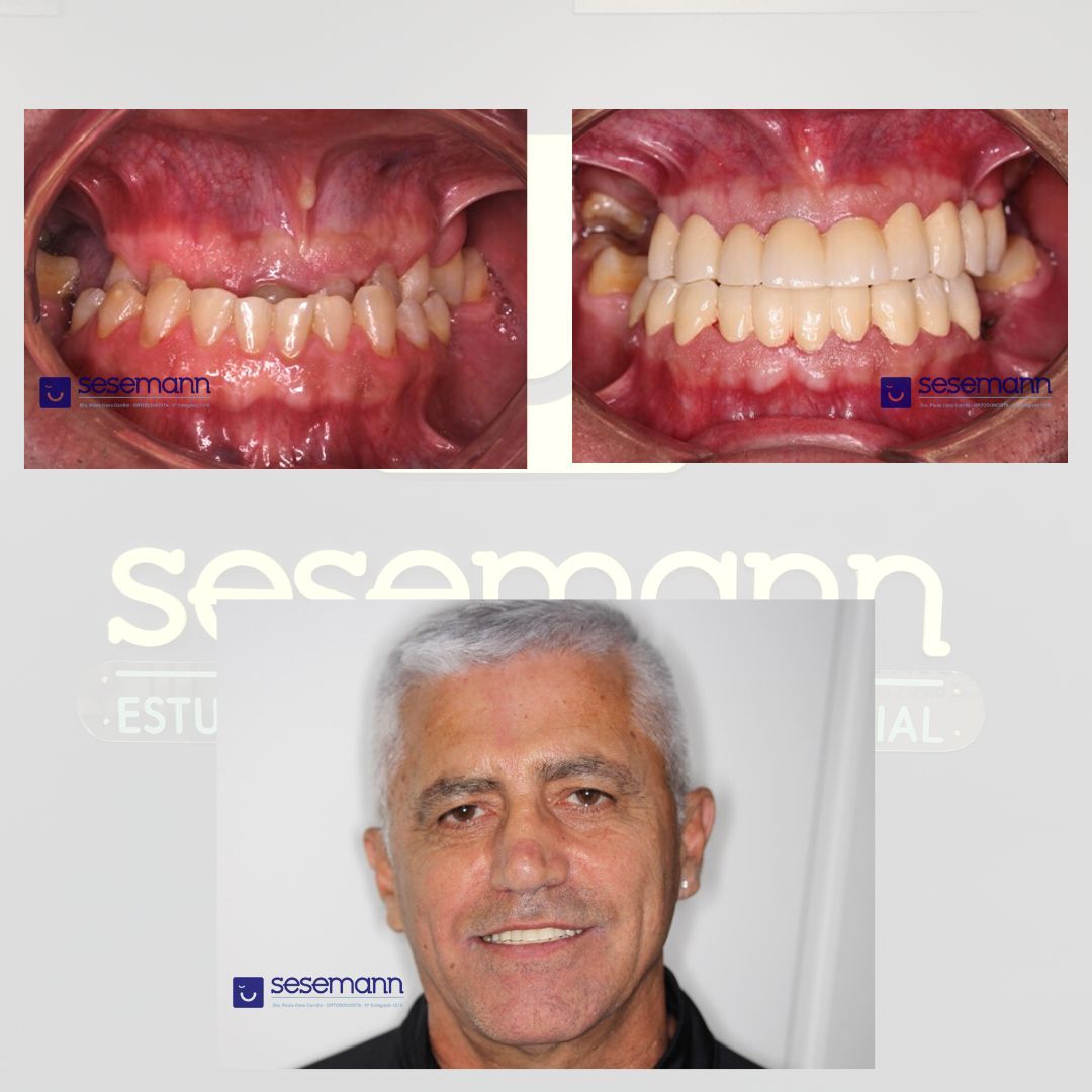 Paula Cano Carrillo-109