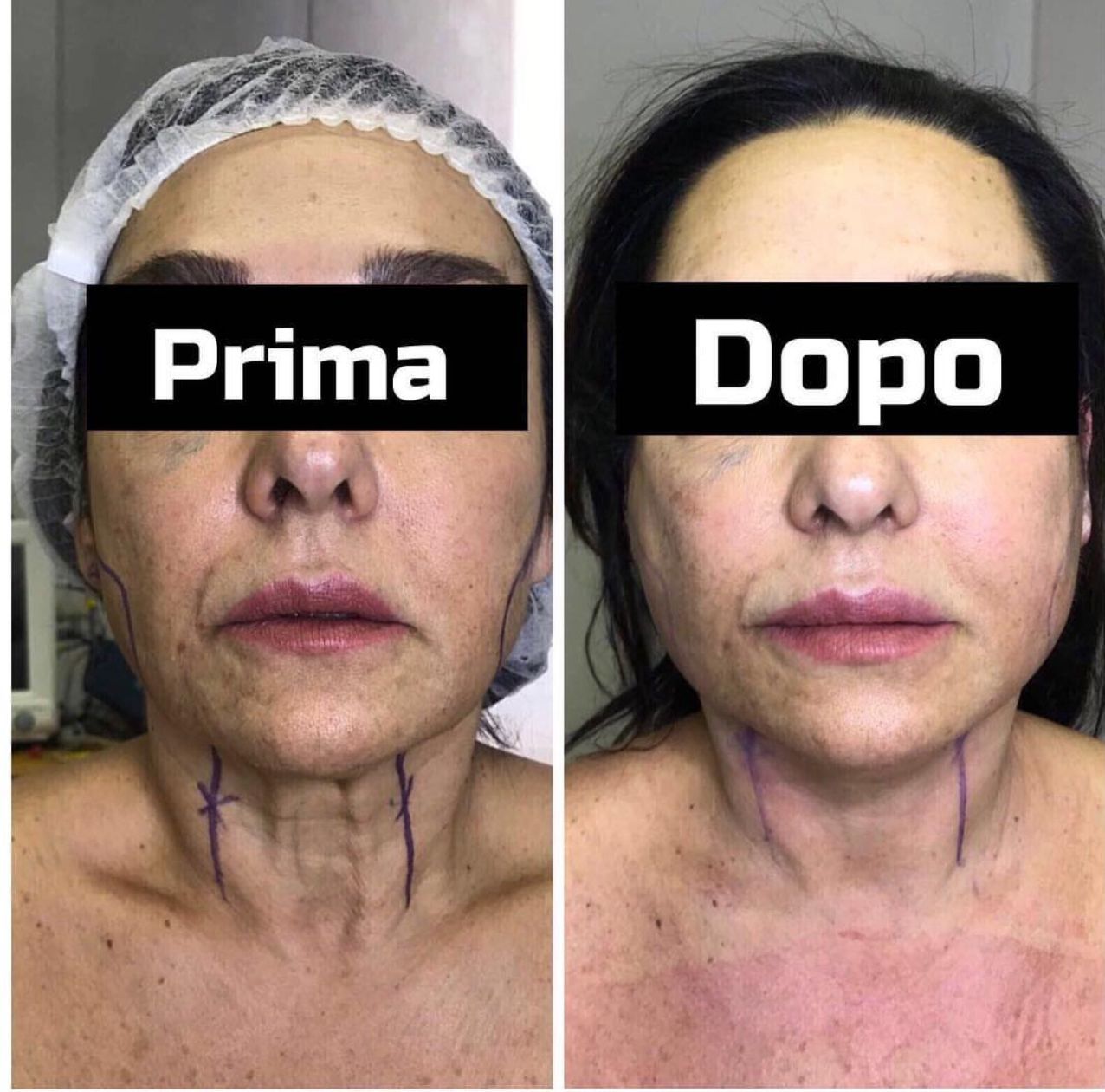 Angelo De Cataldis-0