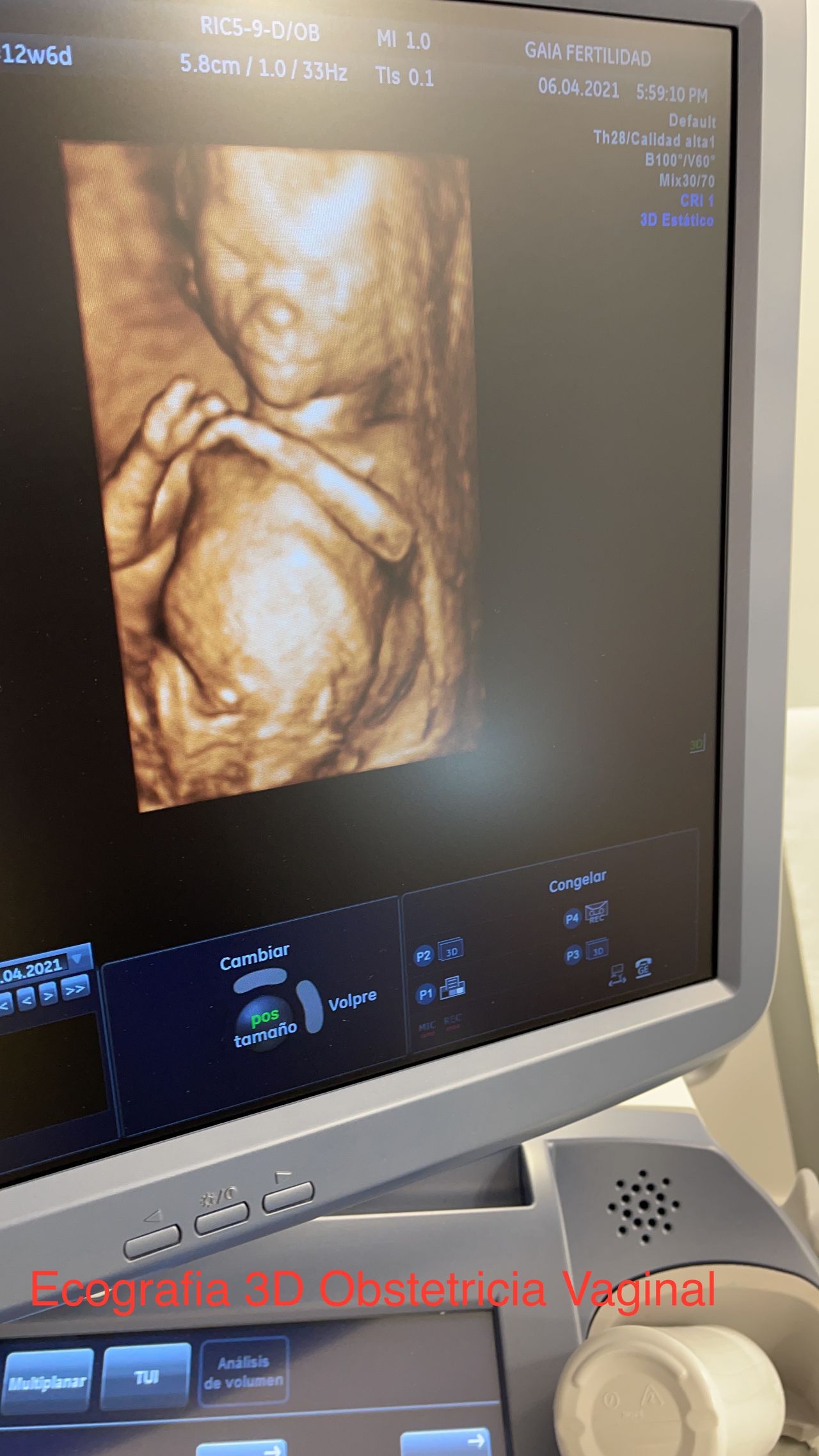 Grether Pérez Diaz-0