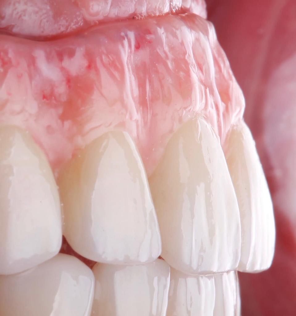 Alessandro Cassese-12