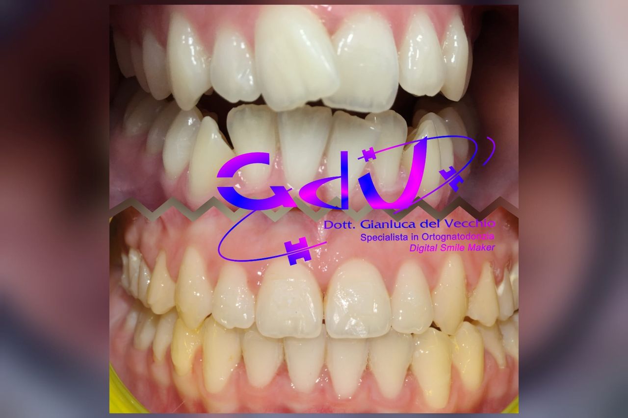 Gianluca Del Vecchio-190