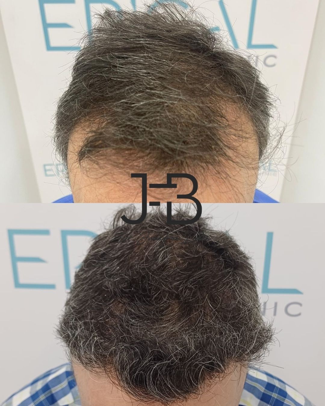 Juan Francisco Belén Montero-9