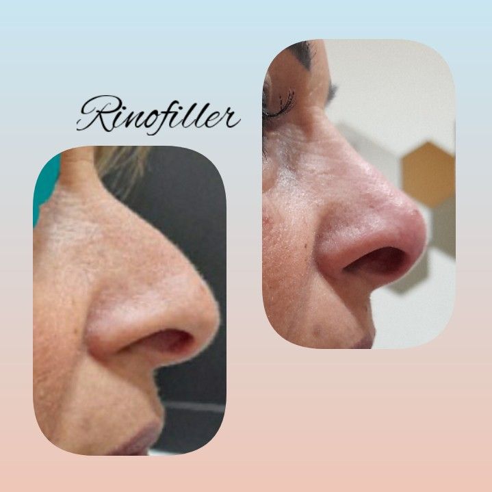 Paola Della Rocca-50