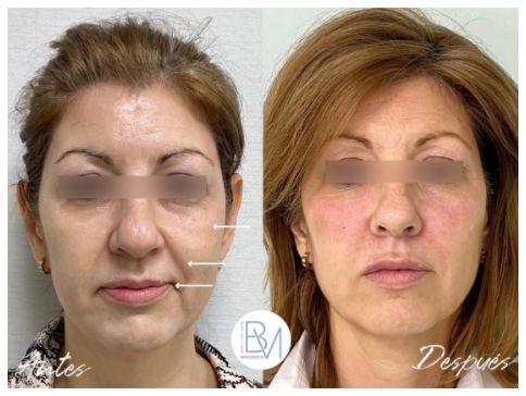 Beatriz Moralejo-141