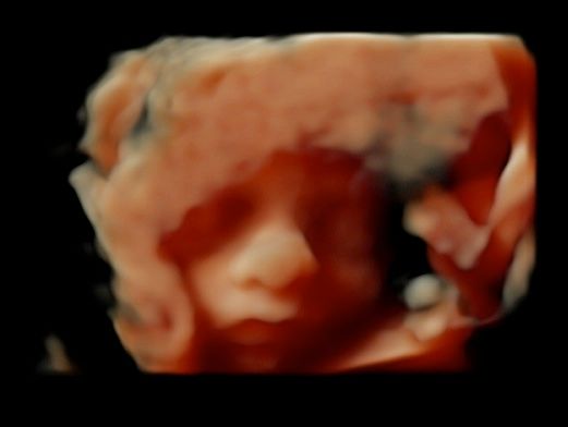 Tommaso Incandela-25