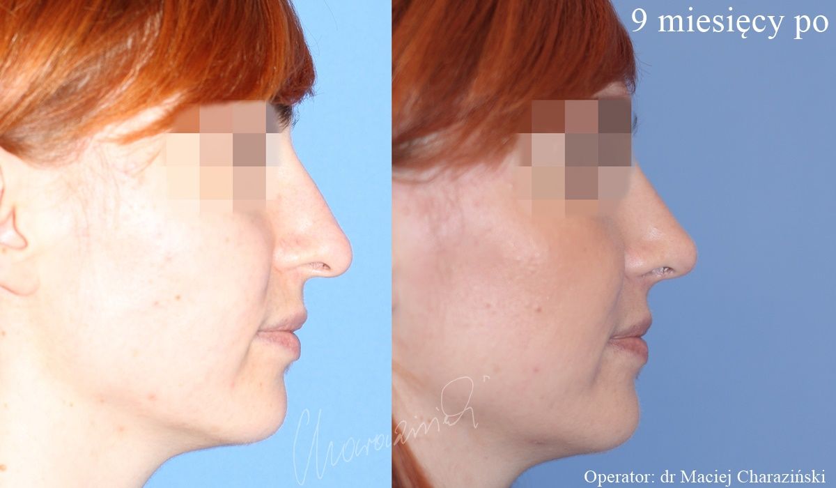 Maciej Charaziński-78