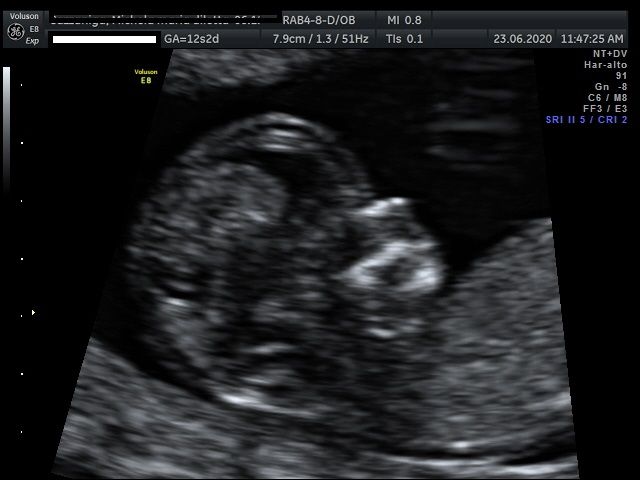 D'ambrosi Francesco-3