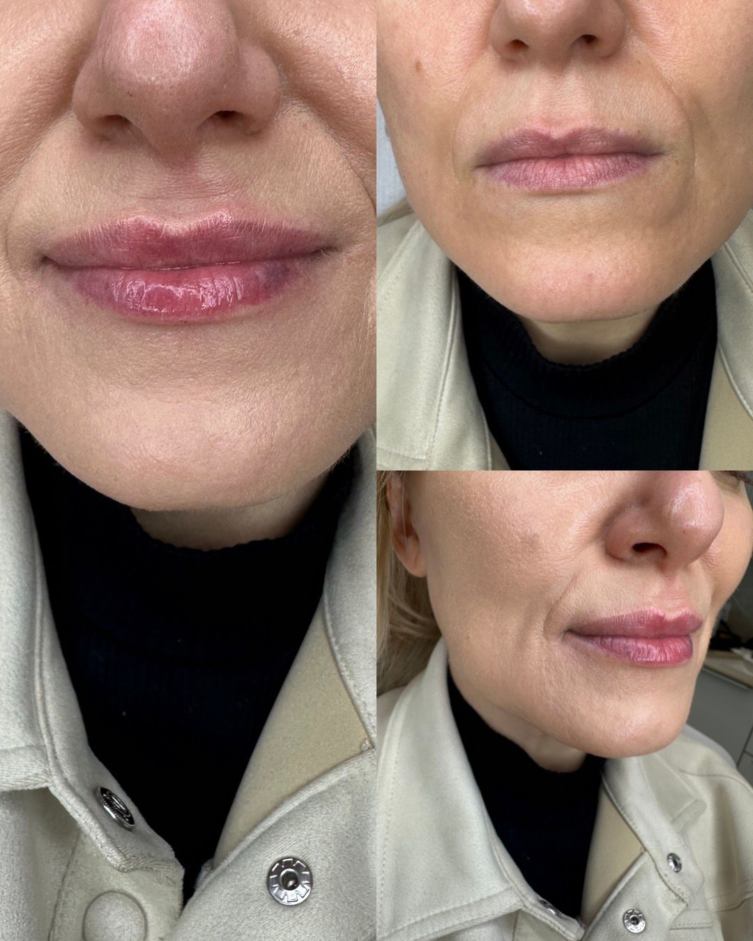 Michalina Zagańczyk-Bączek-30