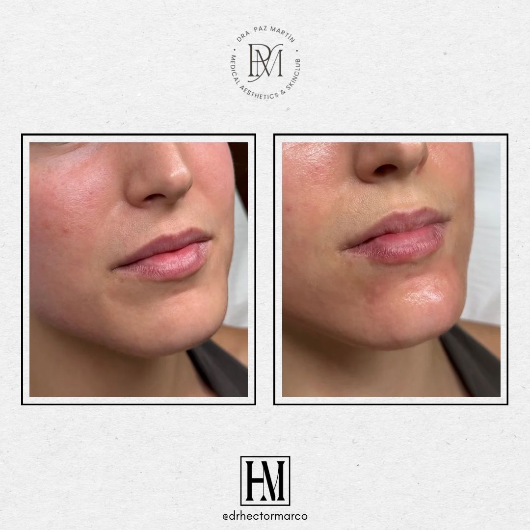 Héctor Marco Ruiz-4