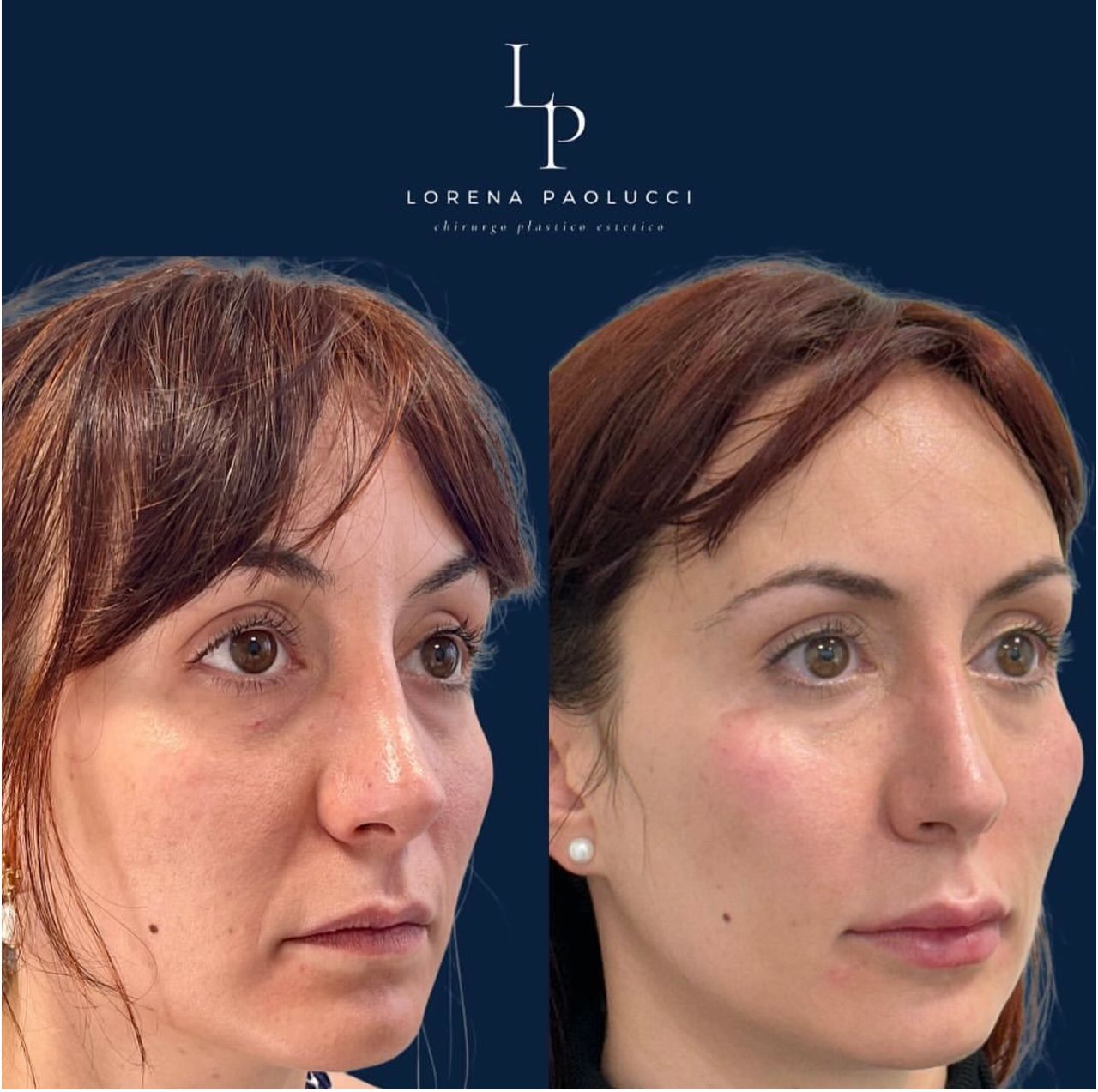 Lorena Paolucci-28