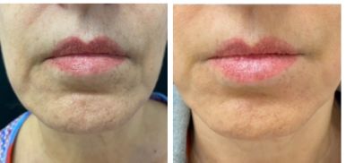 Silvia Melania Baio-26