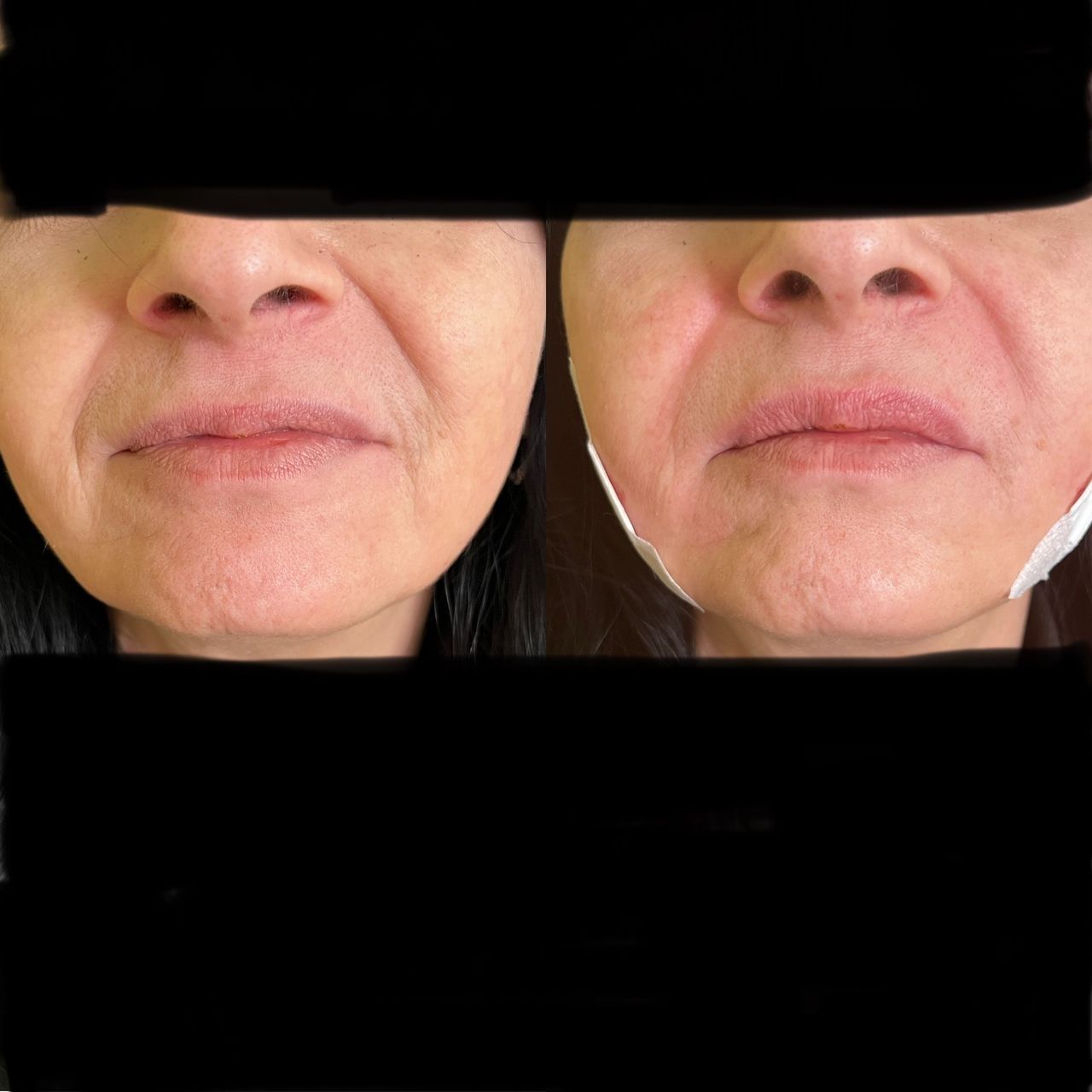 Jacopo Pettinelli-50