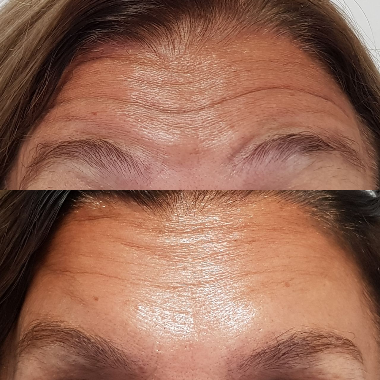 Rosalba Herrero Zerpa-312