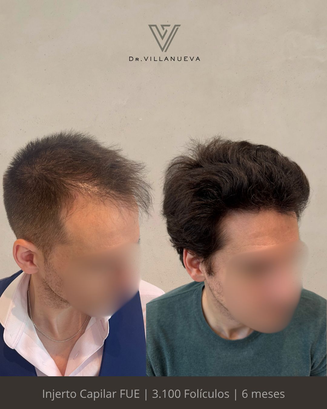 Alfredo Villanueva-9