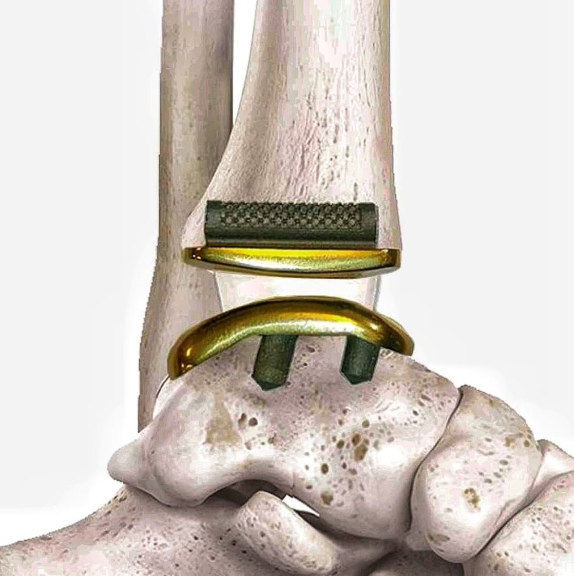 Riccardo Chiavegatti-9