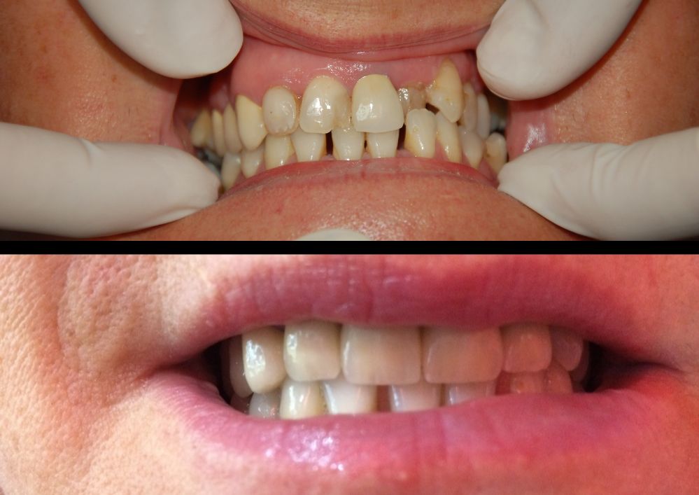 Alessandro Cassese-6