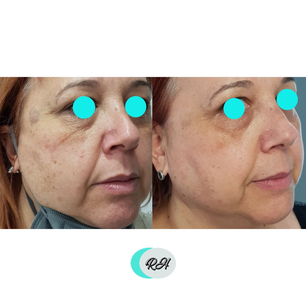 Rosalba Herrero Zerpa-183