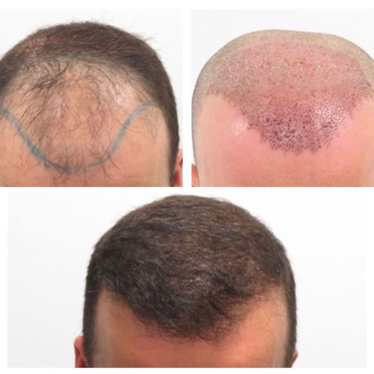 Pasquale Virciglio-23