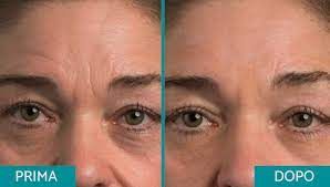 Paolo Bastianelli-37