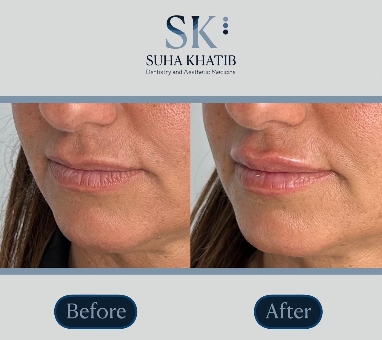 Suha Khatib-9