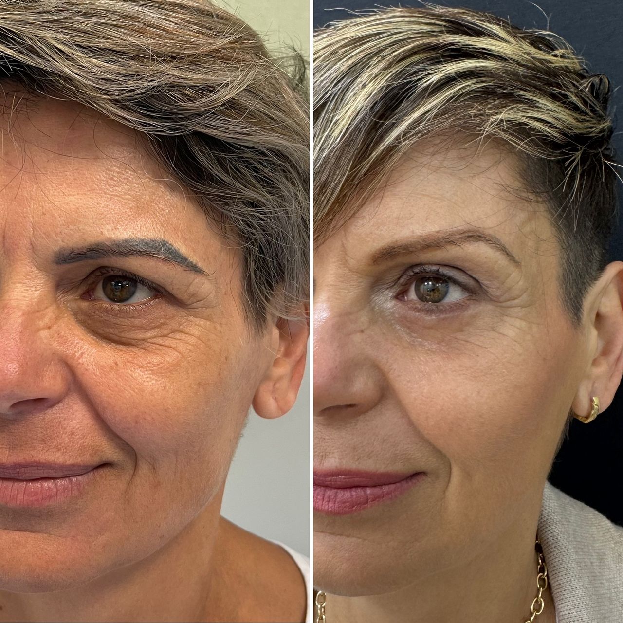 Miklos Molnar-9
