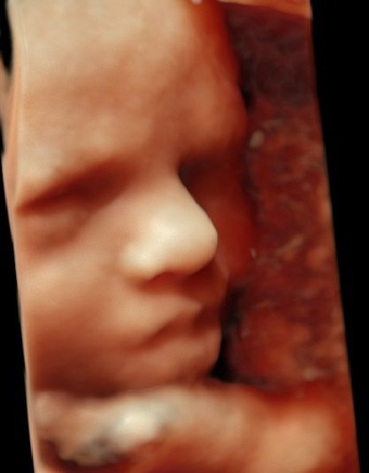 Joanna Krygowska-Zielińska-0