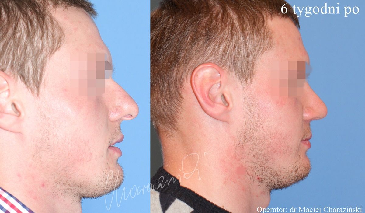 Maciej Charaziński-48