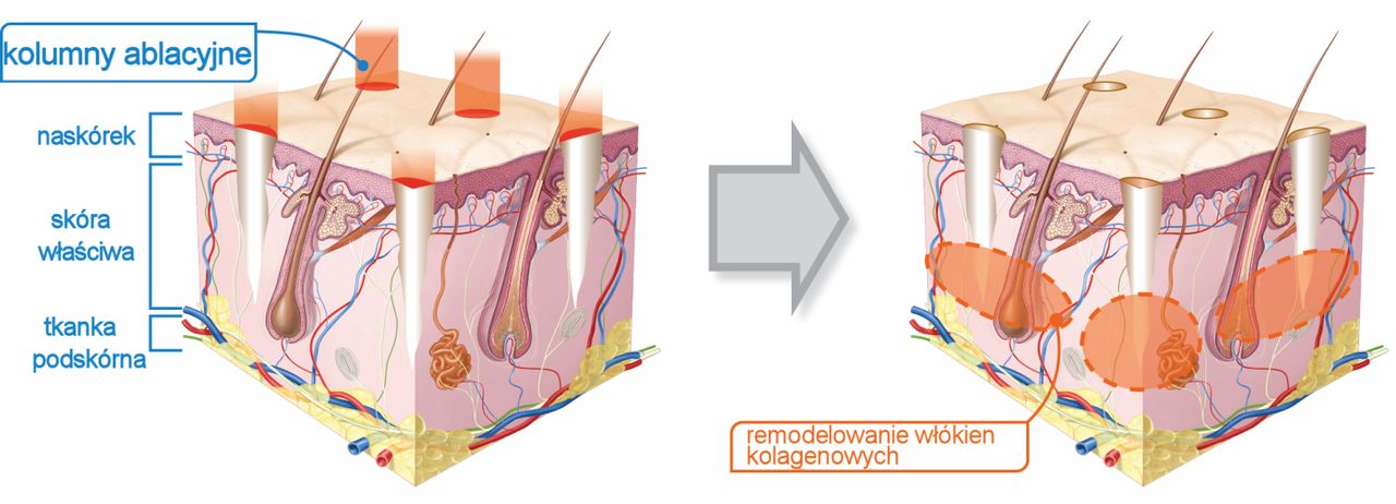 Zbigniew Pietrzak-12