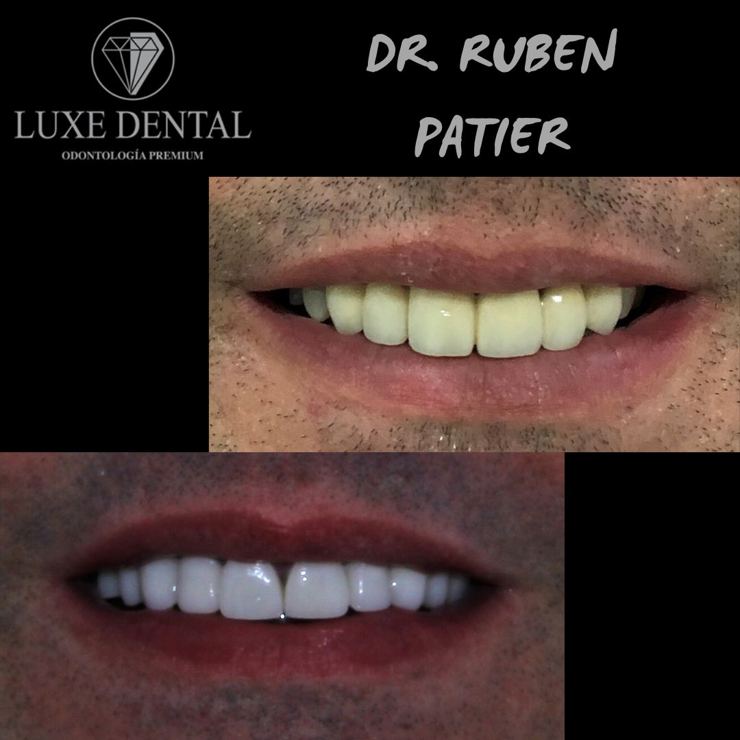 Ruben Patier Martin-30