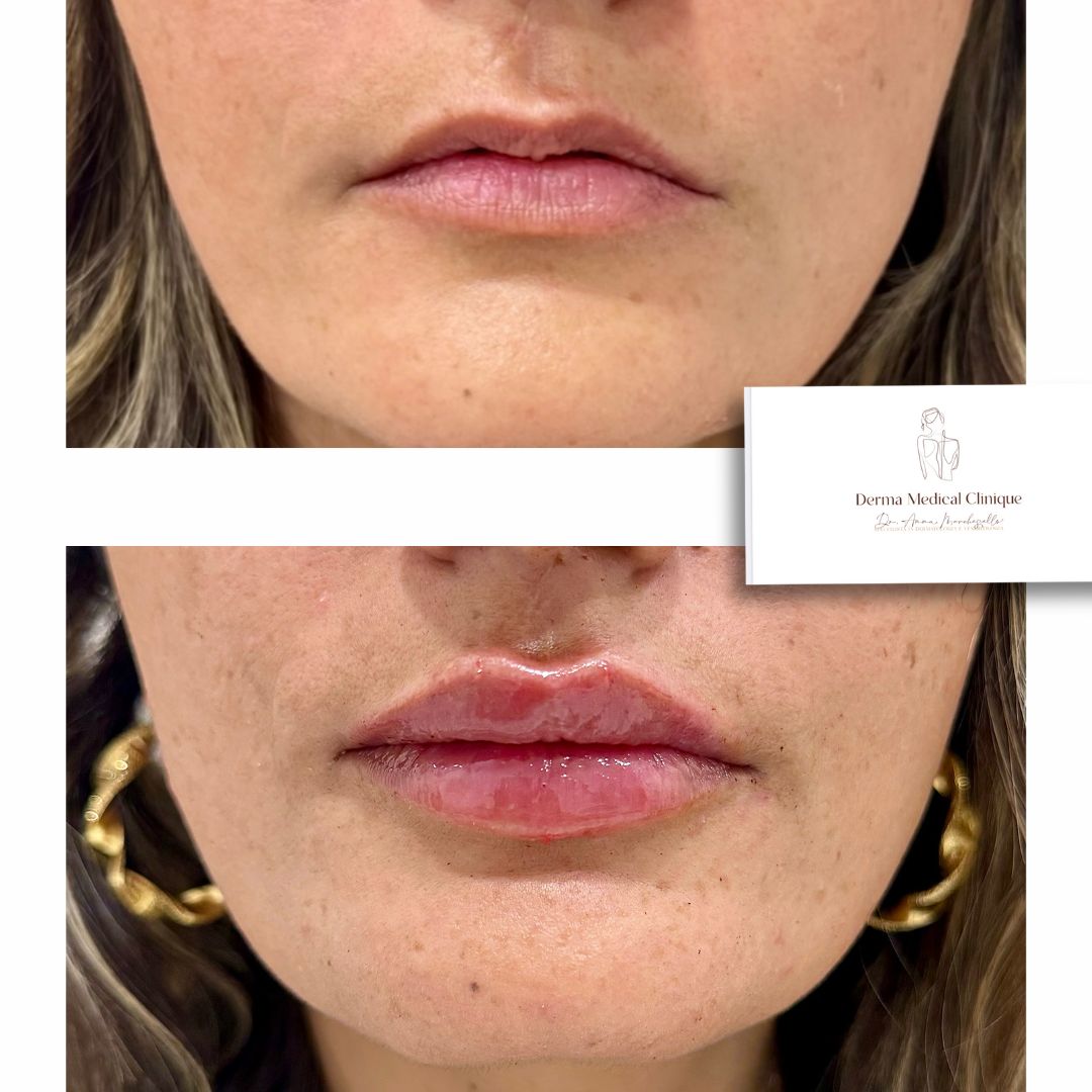 Anna Marchesiello-19