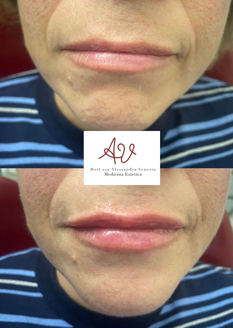 Alessandra Venezia-43