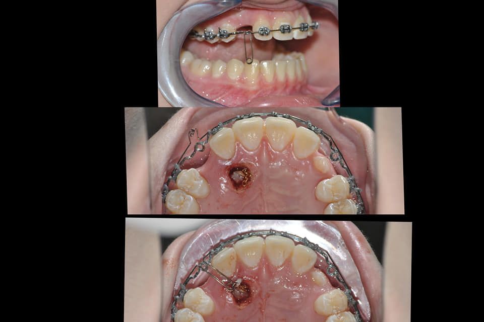 Gianluca Del Vecchio-146