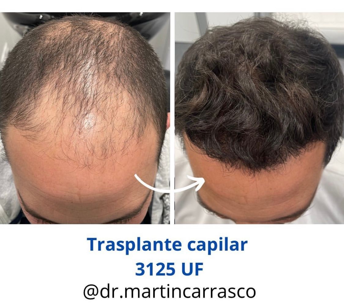 Pablo Martín Carrasco-1