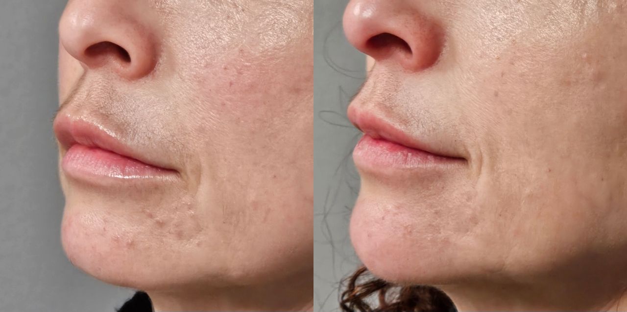 Rosalba Herrero Zerpa-527