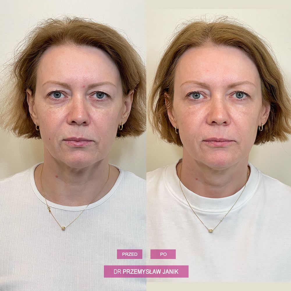 Przemysław Janik-36