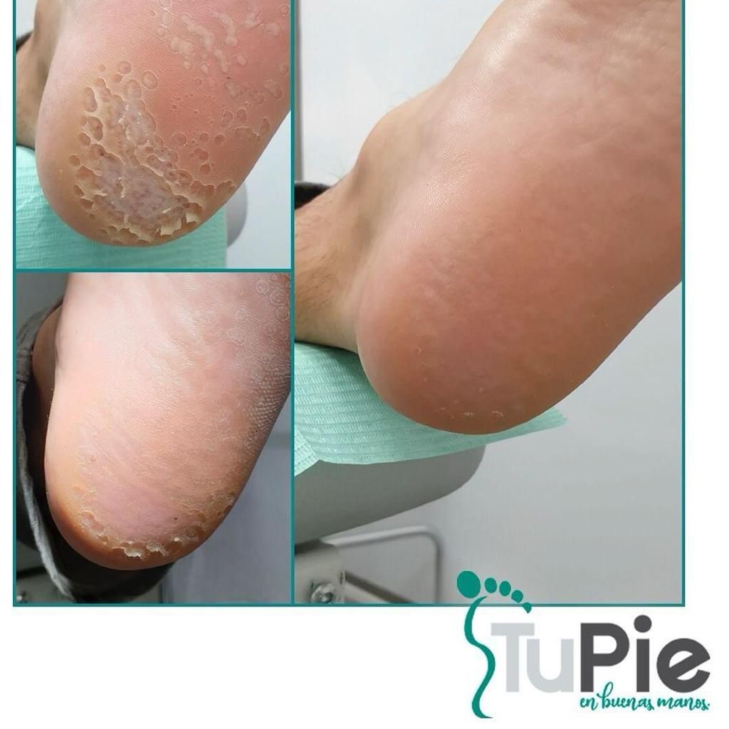 David Palomar Albert-9