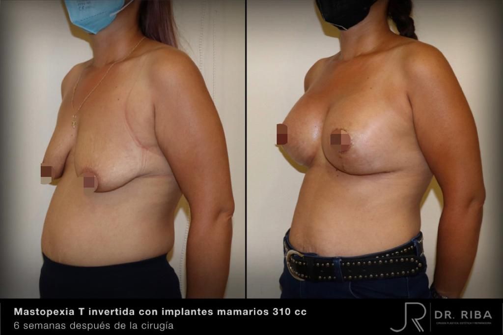 Jordi Riba Vilchez-45