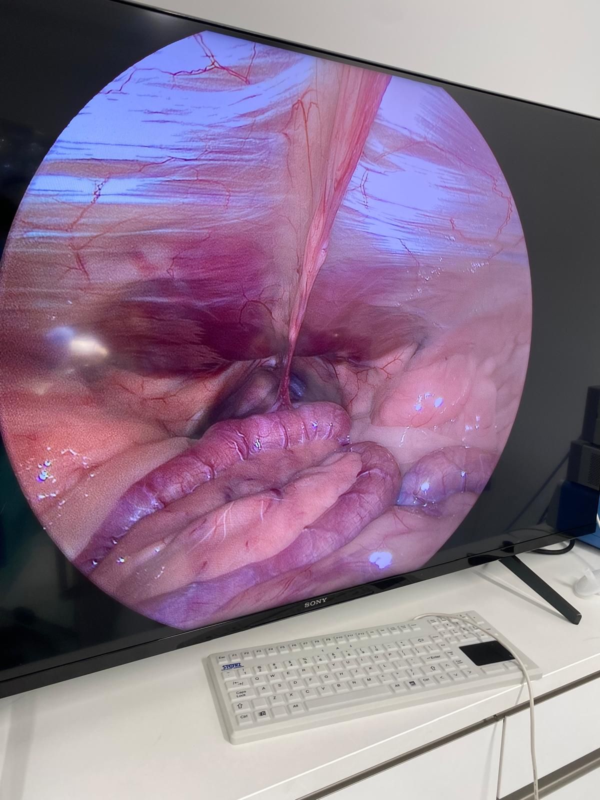 Radosław Fedaczyński-37