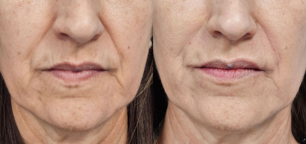 Rosalba Herrero Zerpa-9