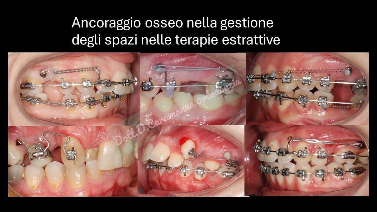 Daniele Caramanna-38