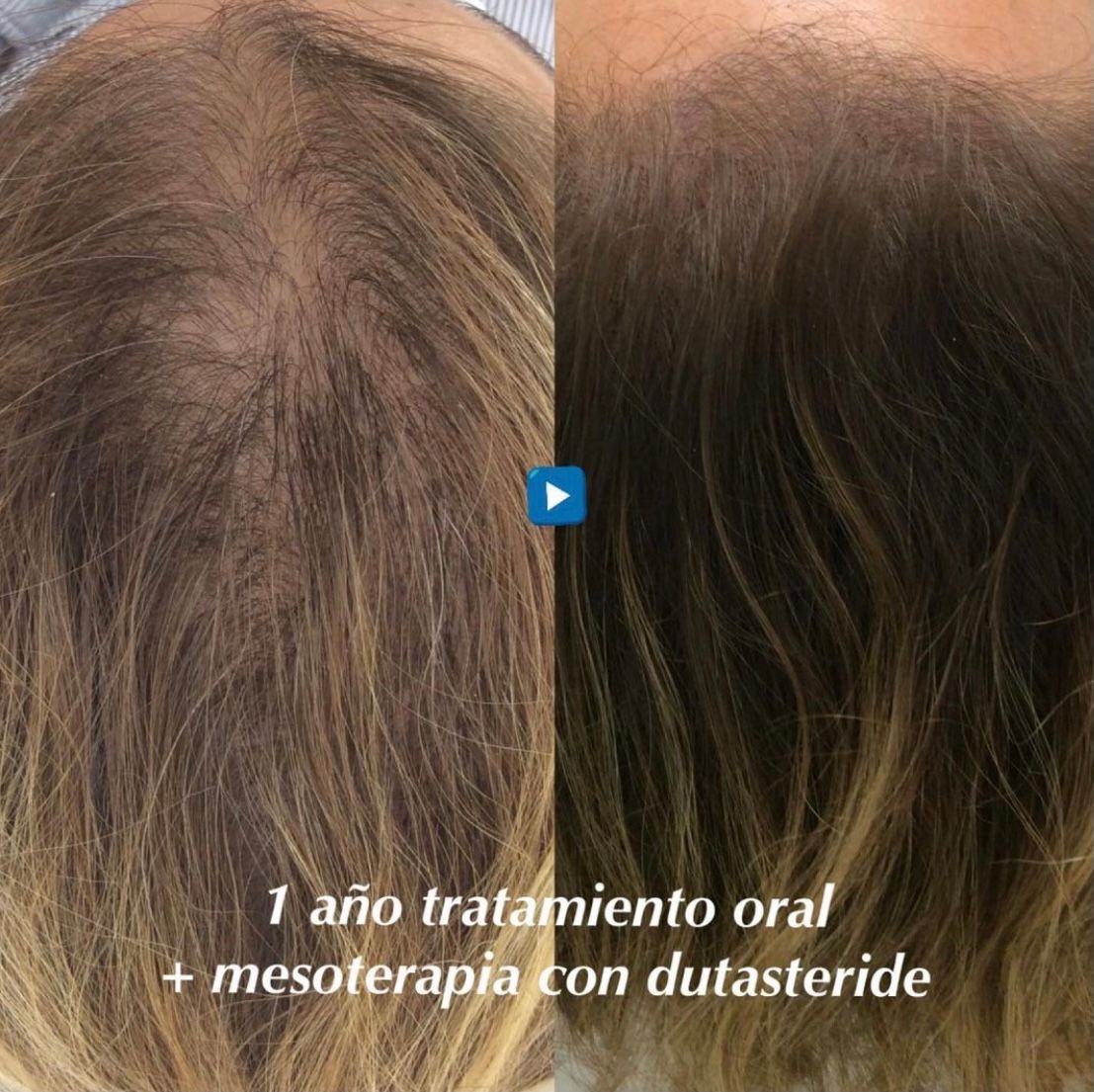 Pablo Martín Carrasco-11