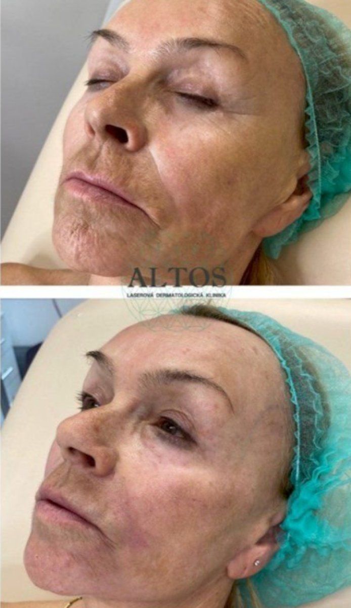 Irina Zvada (Yukhnovets)-9