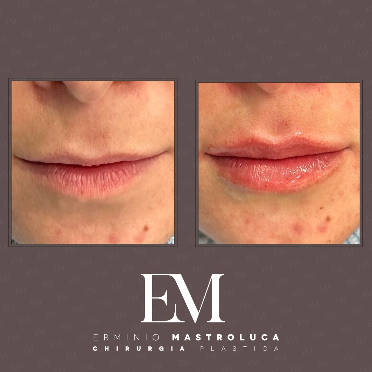 Erminio Mastroluca-21