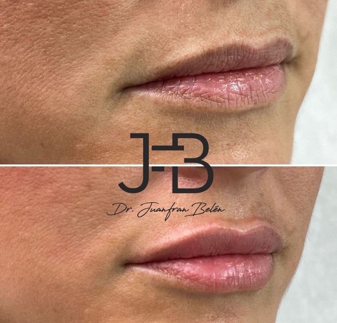 Juan Francisco Belén Montero-24