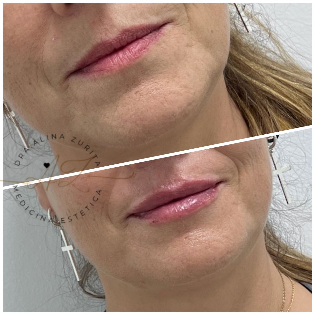 Alina Zurita Estarrona-4