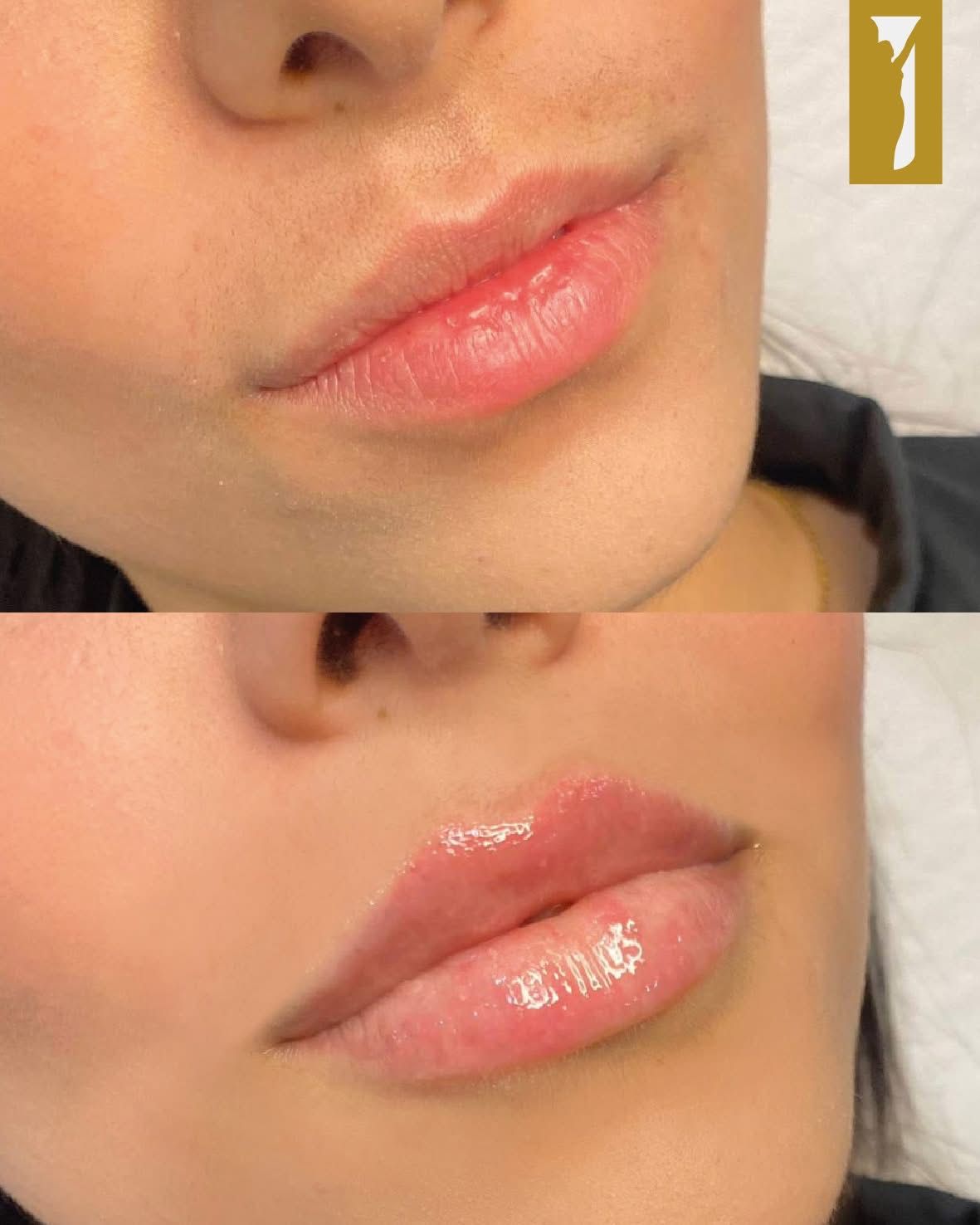 Pasquale Di Costanzo-46