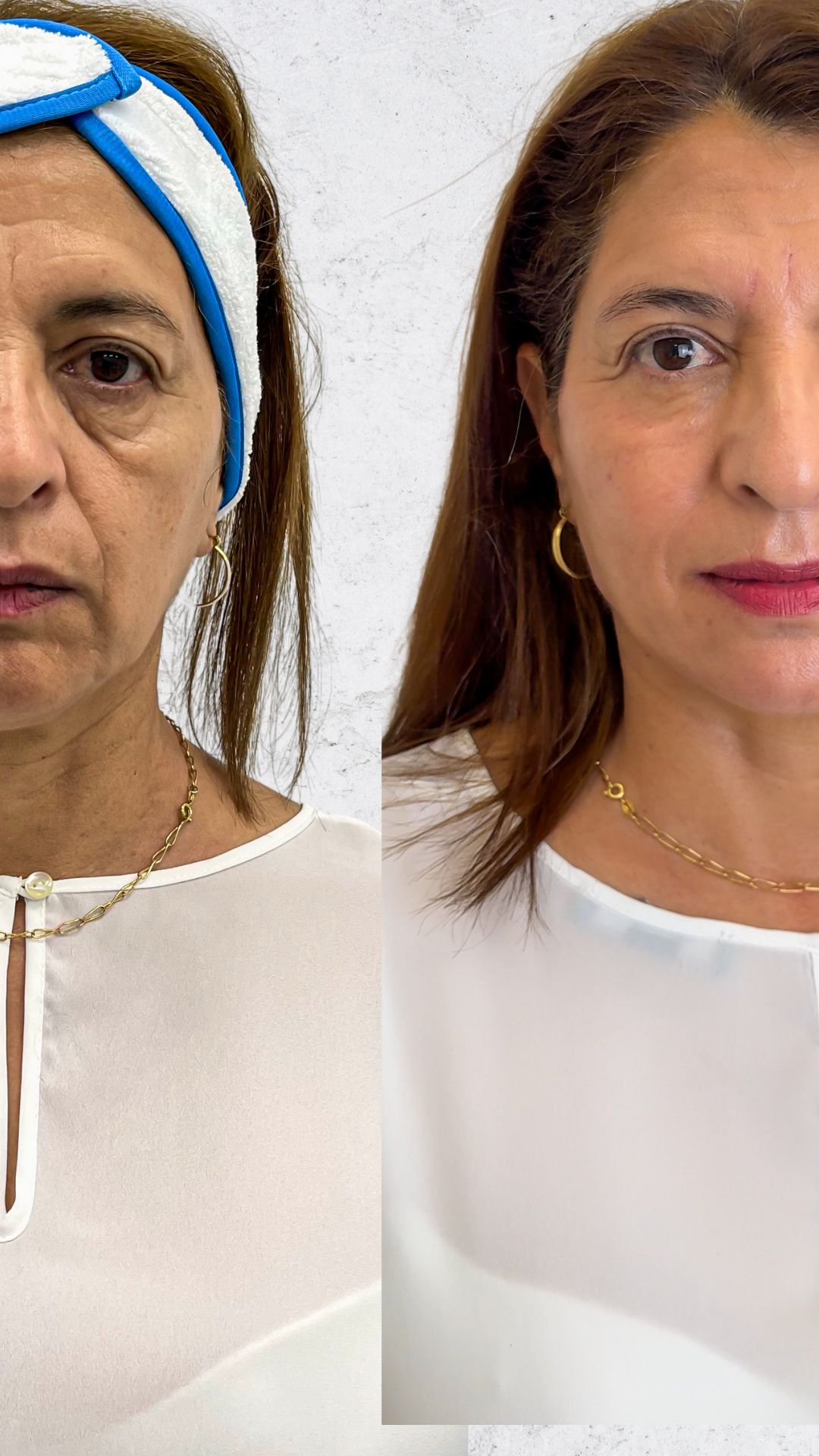 Yusimy Venereo Ramirez-2