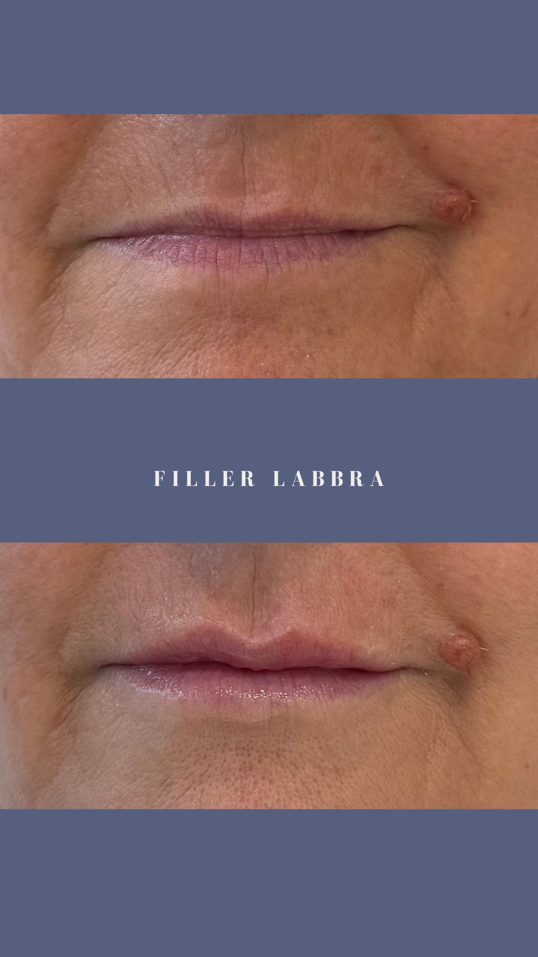 Federica Di Ruscio-36