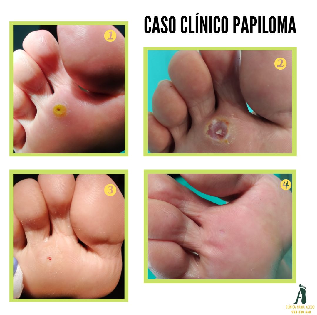 Maria Acedo Cañamero-6